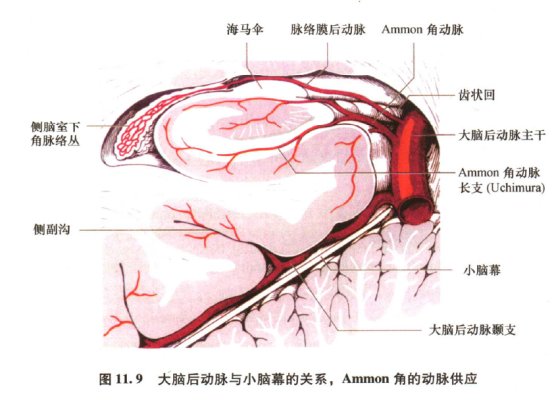 大脑基底动脉尖综合征